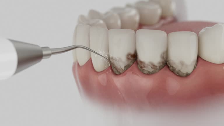 Reliable Dental Implants contractor in Inglis, FL by Smile Center Dentistry